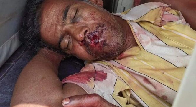 पश्चिम बंगालमा ममता समर्थकबाट लोकतन्त्रको हत्या