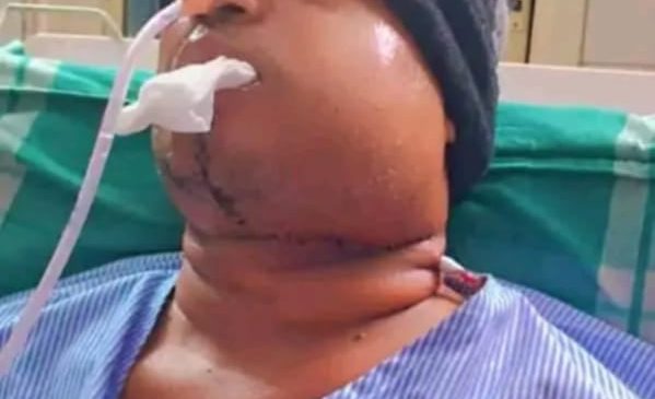 जीवन बचाइदिन क्यान्सरपीडित परिवारको अपिल