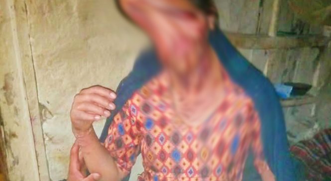 कुकर पड्किँदा बालिका घाइते